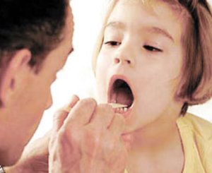 Осмотр полости рта и зева у детей